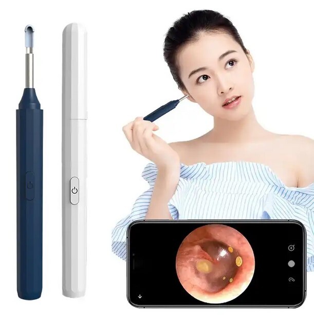 Wireless WIFI HD Ear Cleaning Scope with Visual Digging Spoon USB Endoscope  -image