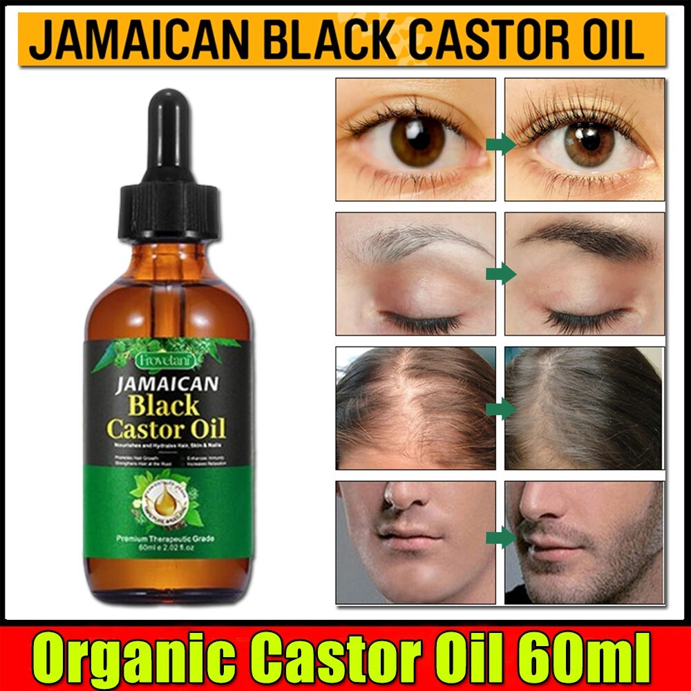Jamaican Black Castor Oil for Hair Growth 2 fl oz US New