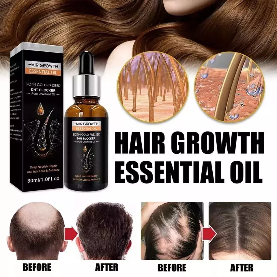 DHT Blocker Grow Your Hair Faster Longer in 1 Week Hair Loss Treatment Oil 30ml