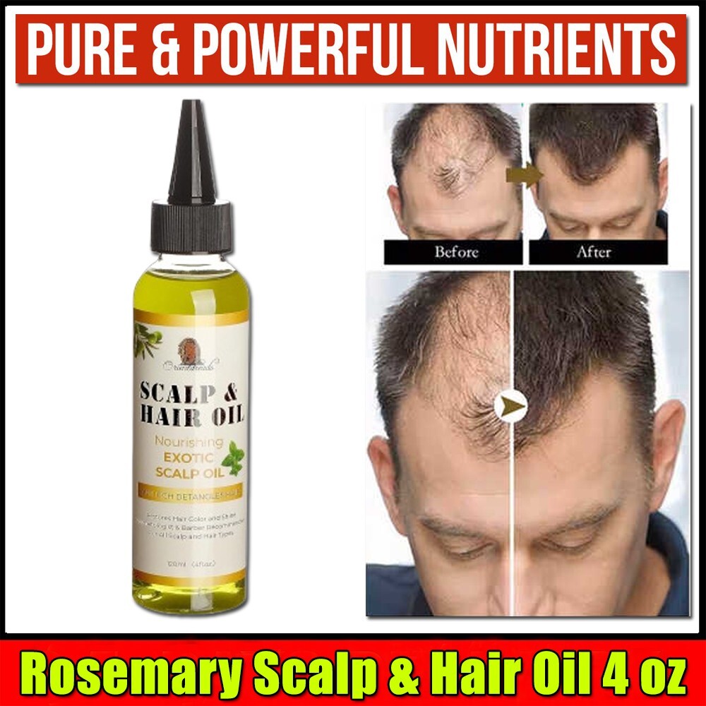 Rosemary Hair Growth Oil - Extra Strength Regrowth Serum for Men & Women 4 oz