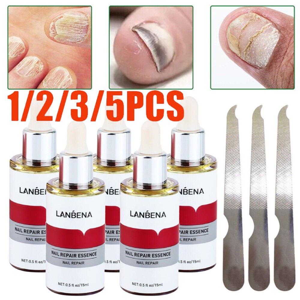 LANBENA Nail Repair Essence for Fungal Treatment & Onychomycosis Removal