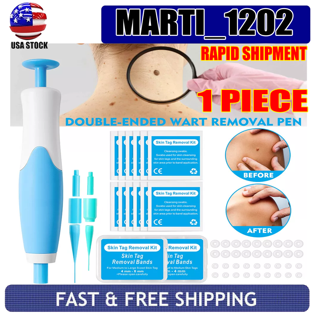 Auto Micro Skin Tag Remover Device Kit Safe Painless Removal 2-8 mm Band Tool