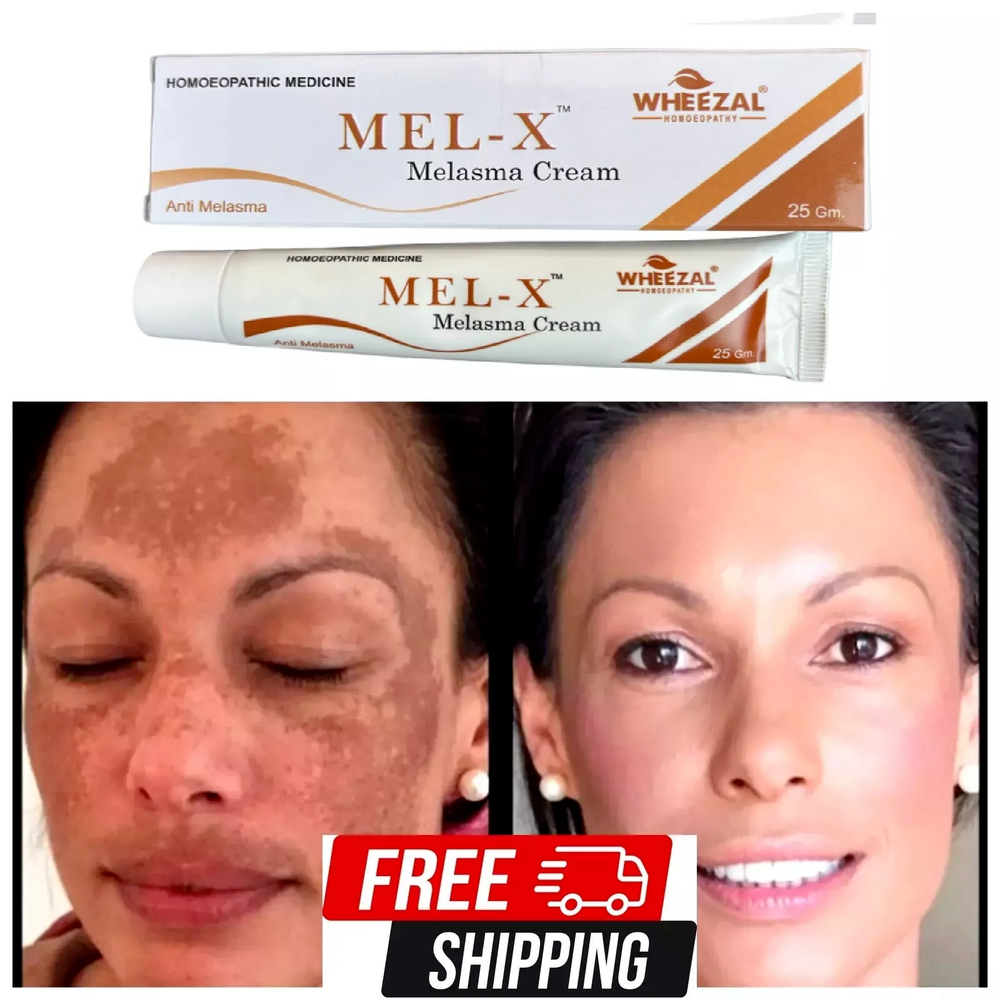 Wheezal Homeopathy Mel-X Cream (25gm) for Skin Pigmentation,chloasma,melasmma