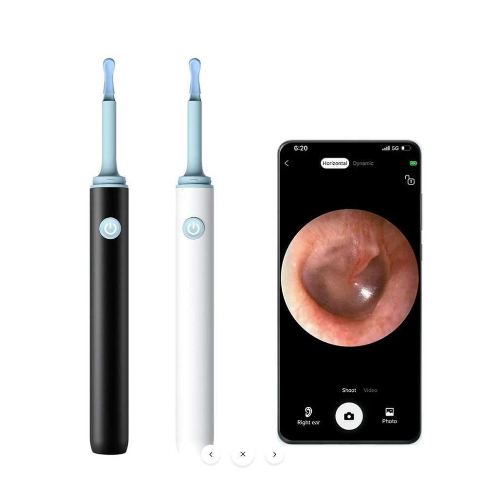 Visual Endoscope Ear Wax Remover with 10Mega Otoscope Camera for Baby and Pet-image