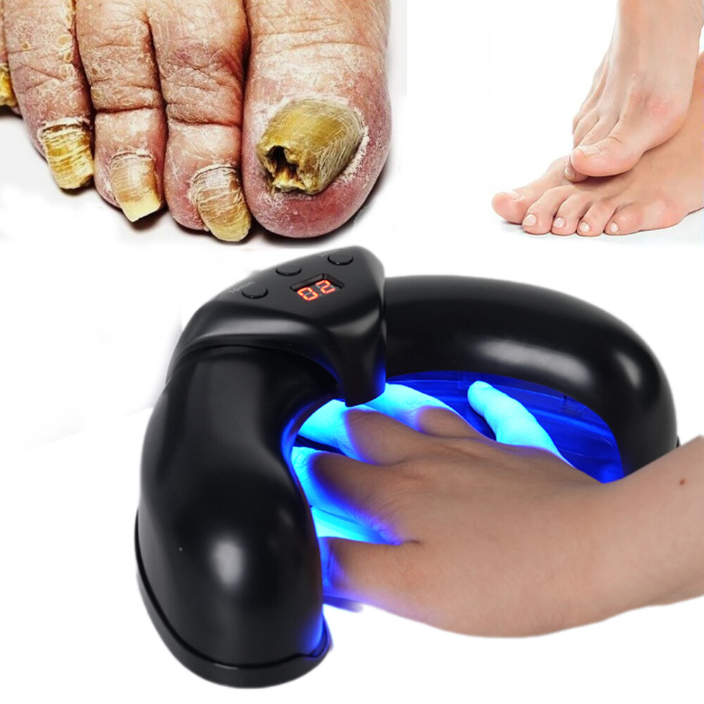 Natural Nail Fungus Treatment for Toenails & Fingernails Non-Invasive Foot Care US