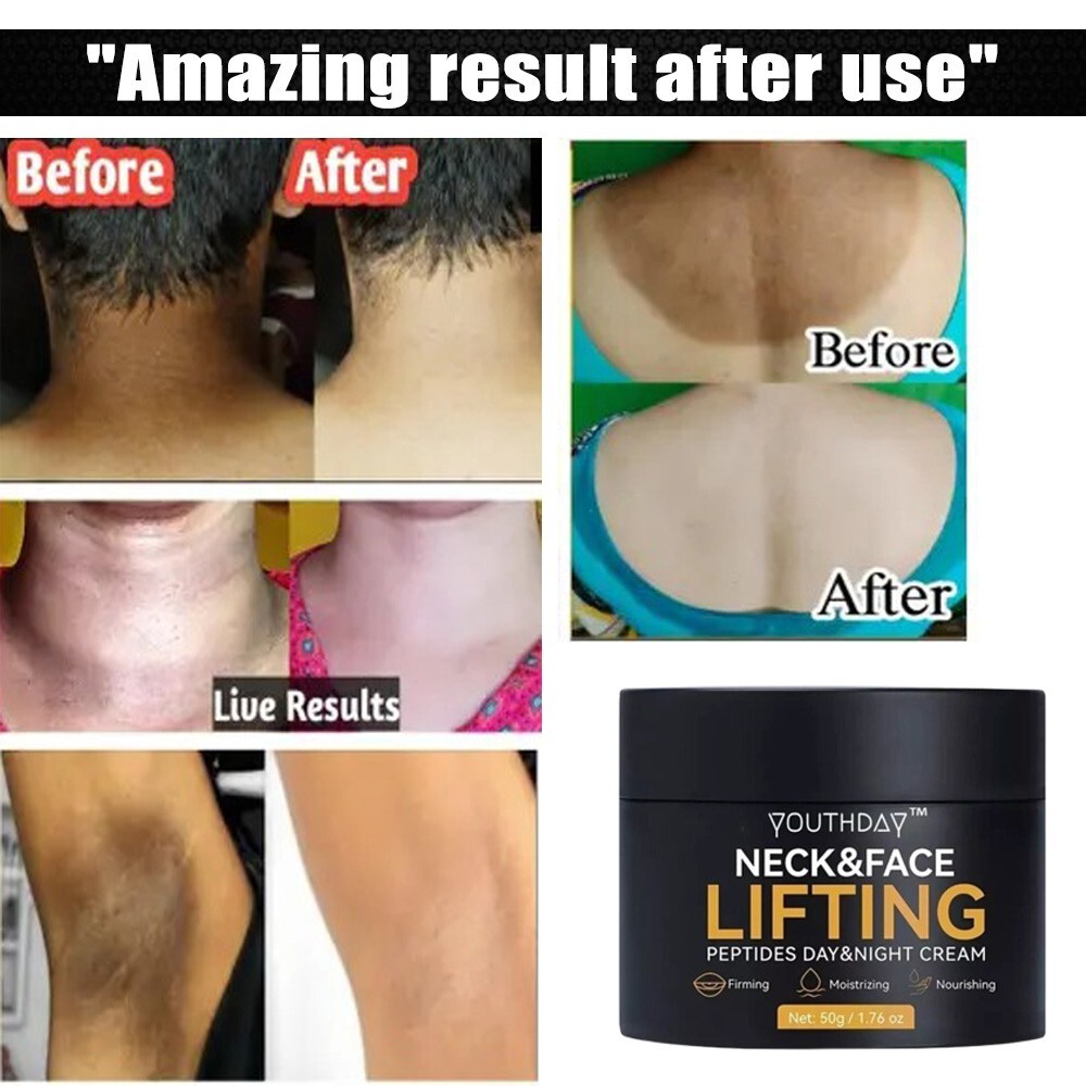 Nourishing Body Cream for Rough & Bumpy Skin – Hydrating & Smoothing Formula-image