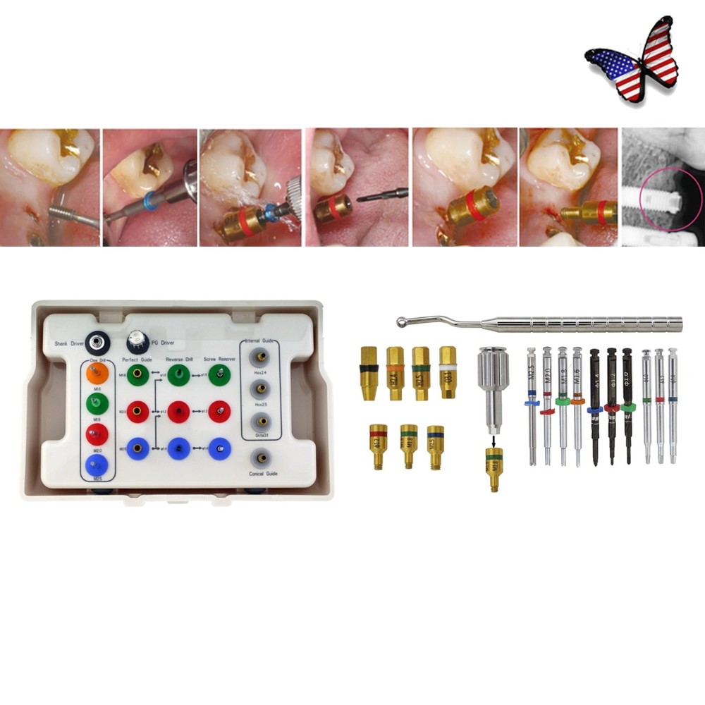 Implant Broken Screw Removal Kit Dental Surgical Tool Fits NeoBiotech SR Repair