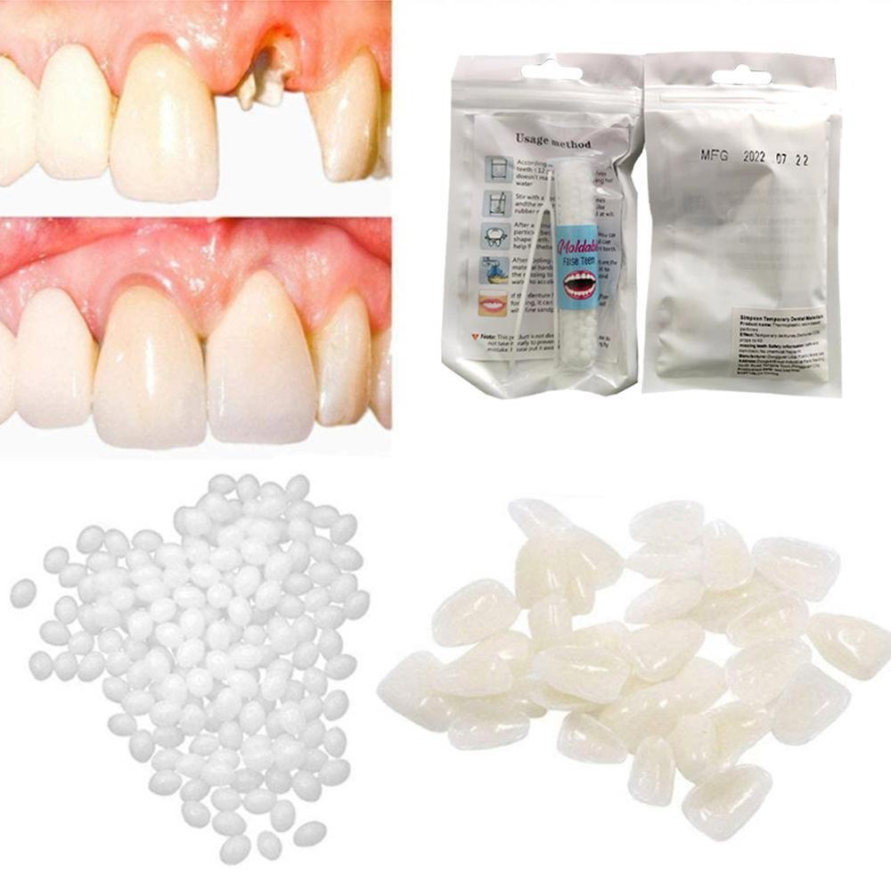 5-20g Temporary Tooth Repair Kit Teeth And Gaps False Teeth Glue Denturefc