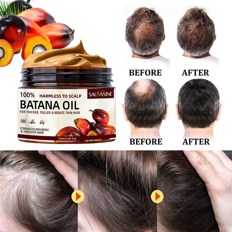 120ml Natural Batana Oil For Hair Growth Healthier Thicker Fuller Anti Hair Loss
