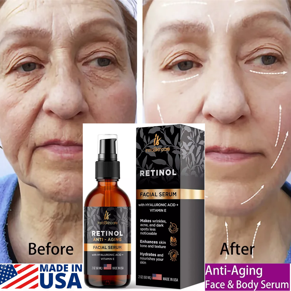 Retinol Serum for Face with Hyaluronic Acid + Vitamin E and A + Aloe Vera (2Oz)